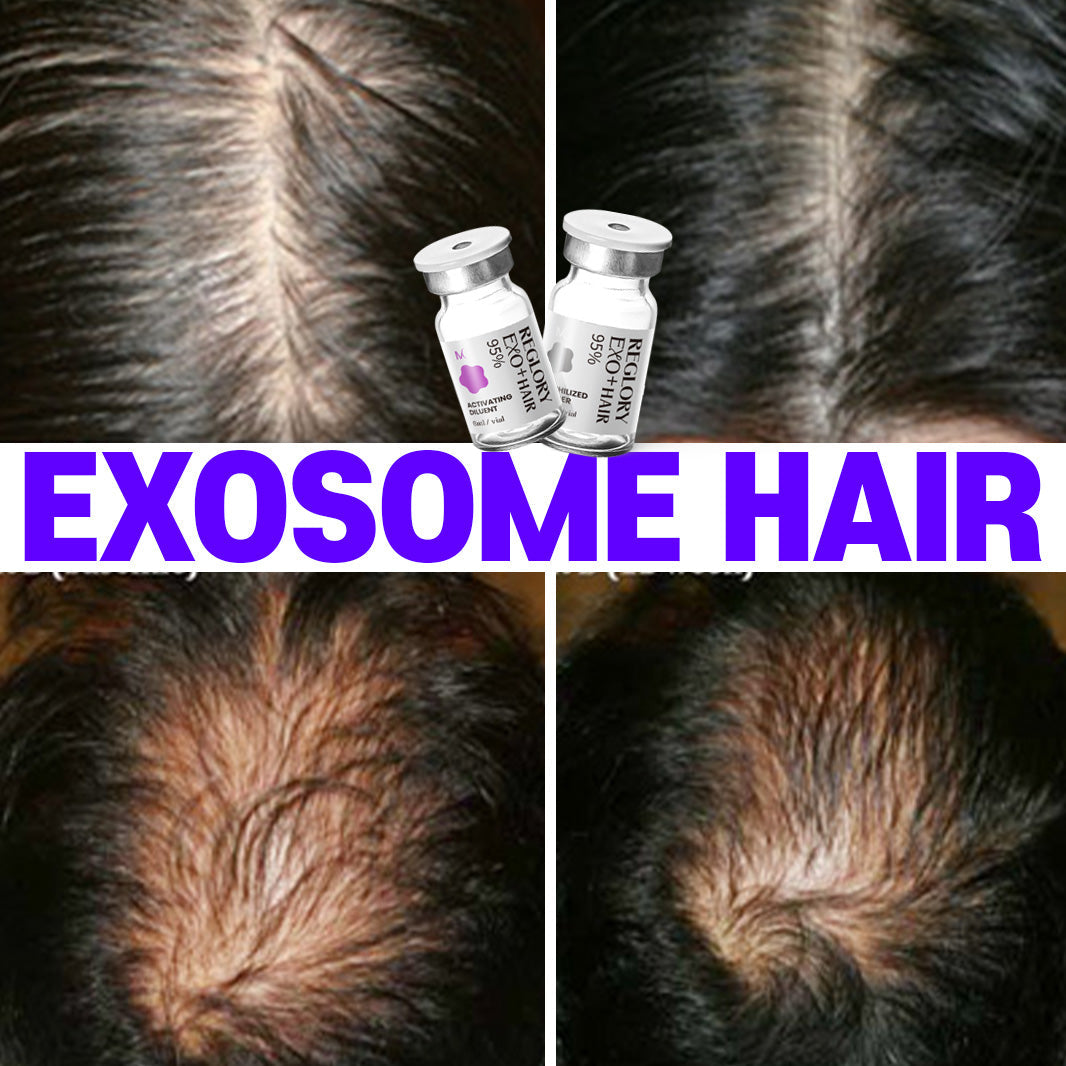 EXOSOME]Unlock the Secret to Healthier, Fuller Hair with REGLORY