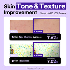 Lesimo Niatamin B3 10% Serum 1X50ml Lesimo Niatamin B3 10% Serum 1X50ml