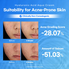 Lesimo Hyaluronic Acid Aqua Cream 1X100ml