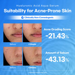 Lesimo Hyaluronic Acid Aqua Serum 1X50ml