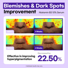 Lesimo Niatamin B3 10% Serum 1X50ml