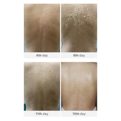 Medisco Peelieve Peeling 5X1g+5X8ml